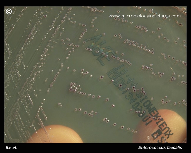 colonies of Enterococcus faecalis, VRE bacteria 